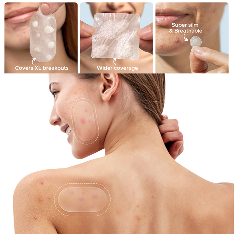 Beauty And Makeup Quotes - 116 Stuks Anti-Acne Patches Vlekken Marks