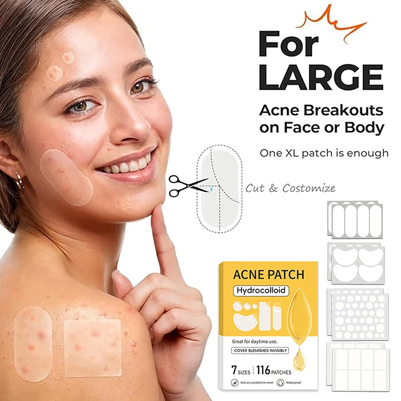 116 Stuks Anti-Acne Patches Vl - Beauty And Makeup Quotes recensie en prijs